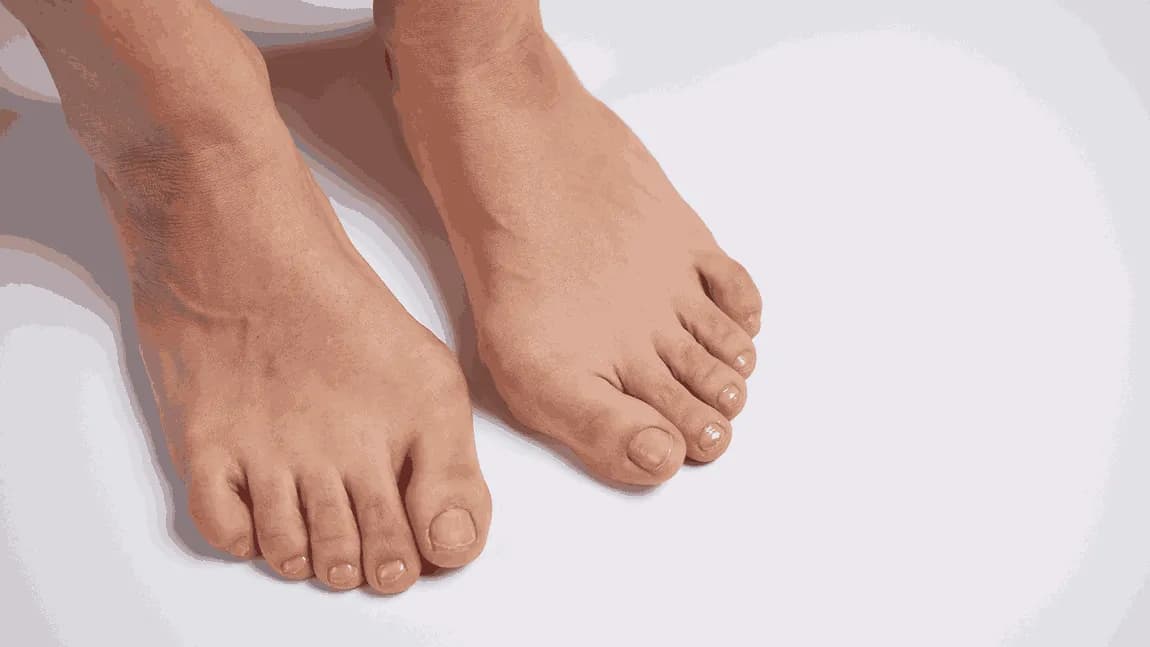 Flat Feet in Kids: Harmless Condition or Cause for Concern?