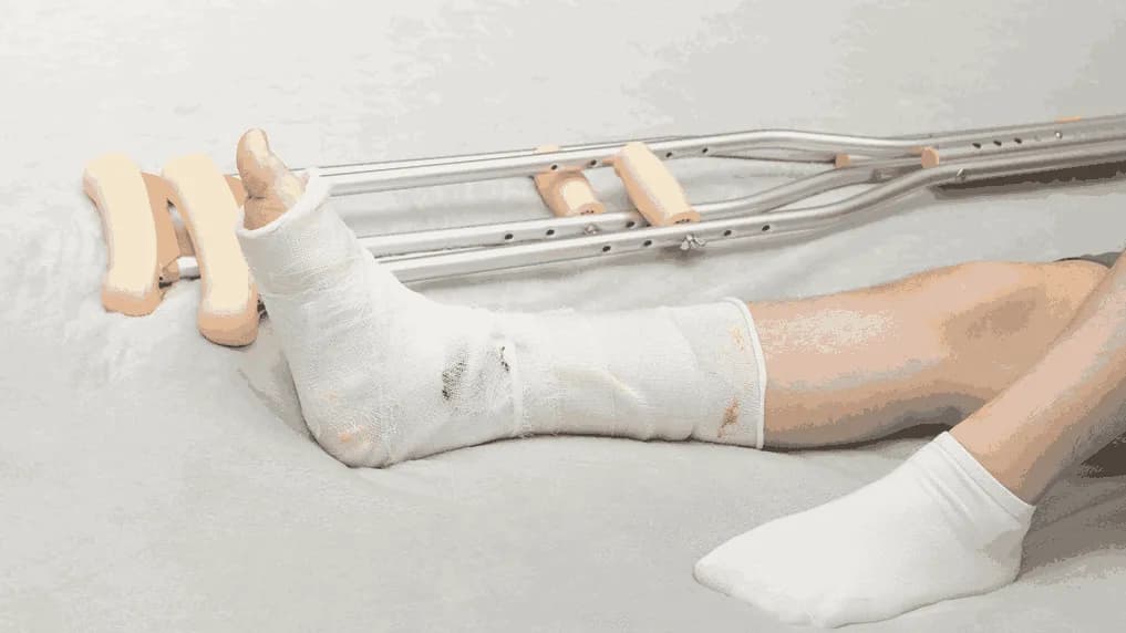 Fracture Care in Children: What’s Different?