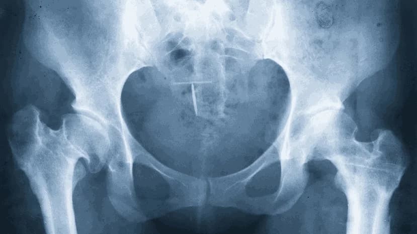Best Age for Correcting Bone Deformities in Children