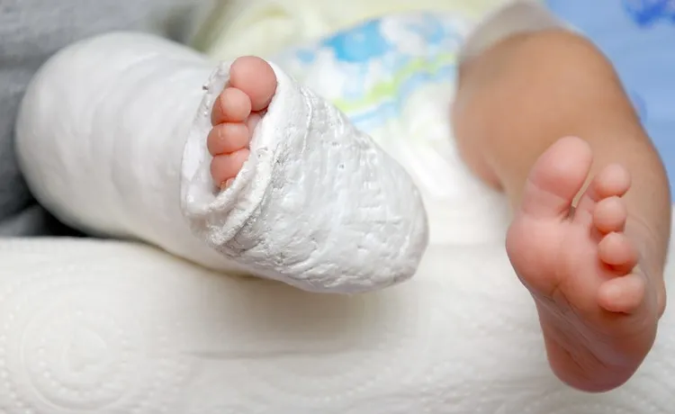 Child Bone Specialist in Delhi