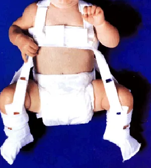 Best Developmental Dysplasia of the Hip (DDH) Treatment in Noida