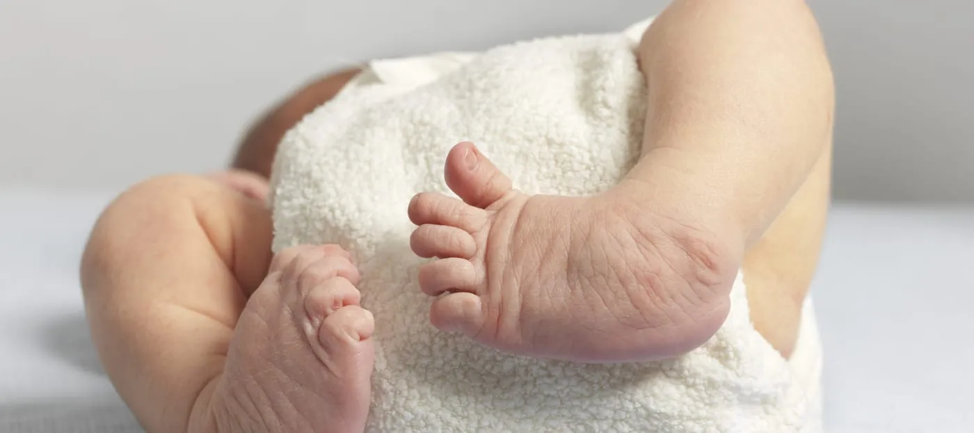Best Clubfoot Treatment in Sonipat