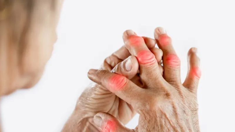 Calcium Deficiency Treatment in Noida