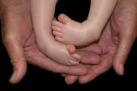 Best Clubfoot Treatment in Patiala