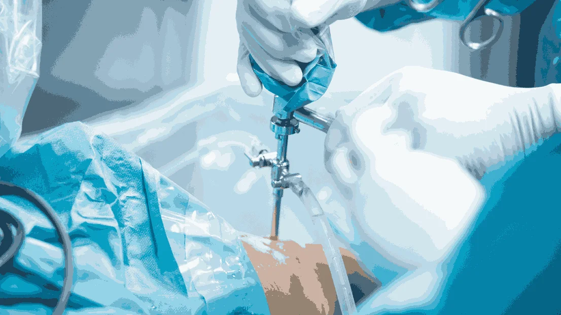 Indian Expats Returning for Pediatric Orthopedic Surgery