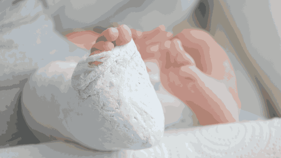 Understanding Clubfoot in Babies: Causes, Signs & Treatment Options