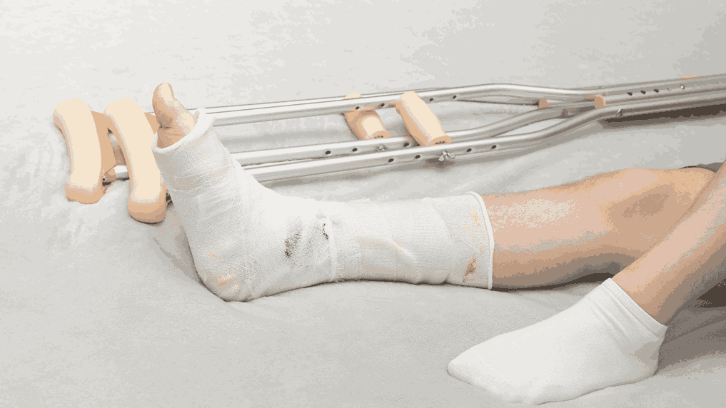 Fracture Care in Children: What’s Different?