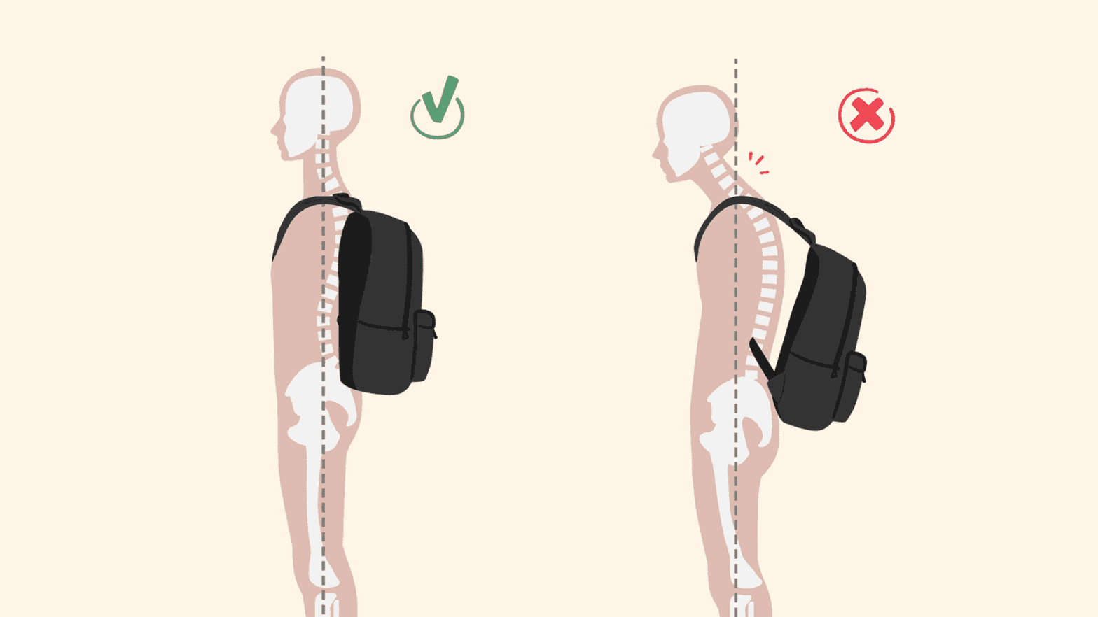 Avoiding Backpack-Related Back Problems in Kids