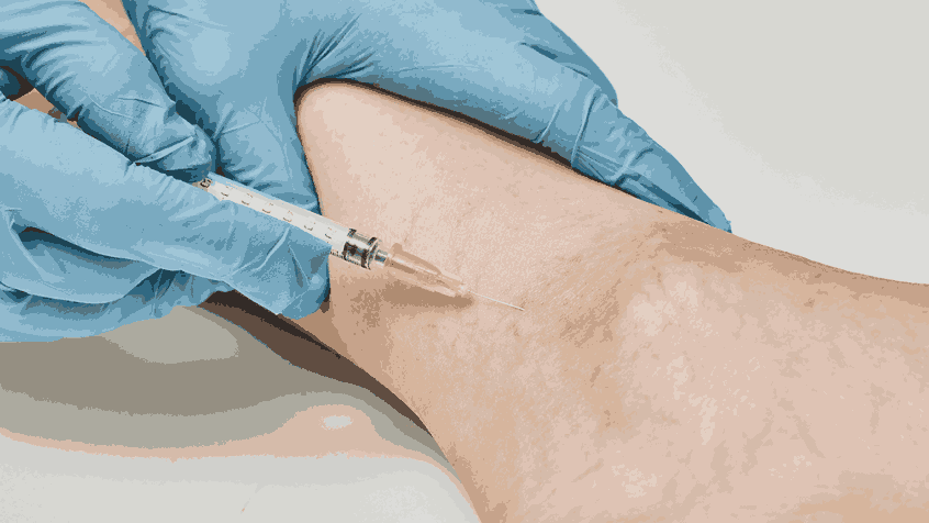 Clubfoot in Babies – Diagnosis and Modern Treatment Options
