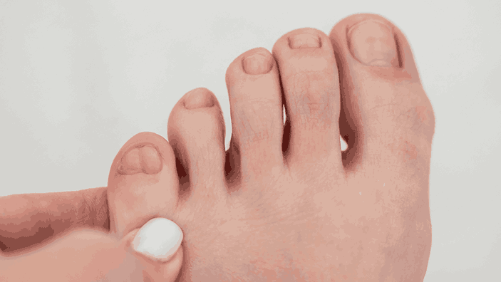 Congenital Hand Deformities – Types and Modern Treatments